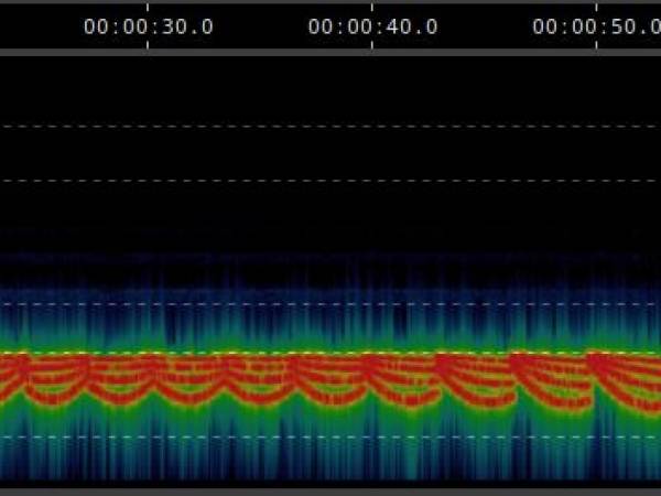 Sonogramm 3